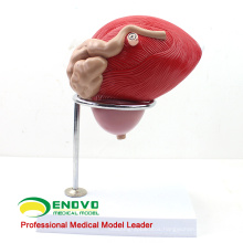 UROLOGY08(12428) Human Male Urinary Bladder with Prostate Model - 2 Parts, 3x Life-Size